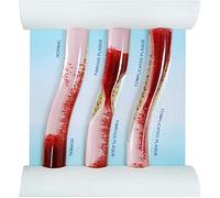 Low-Density Lipoprotein BloodModel, Human Body Skeleton Anatomical Model for Medical Patient Doctor Teaching, Dynamic B