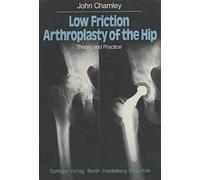 Low Friction Arthroplasty of the Hip: Theory and Practice