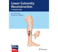 Lower Extremity Reconstruction: A Practical Guide