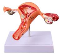 Lpitoy Human Female Uterus and Ovary Model, Female Genital Organ, Reproductive Organ Model, Uterine Medical Teaching Anatomical Gynecology Uterus Ovary Model