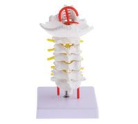 LRXIYODE Human Cervical Spine Medical Model with Carotid Simulation, Posterior Occipital Bone and Intervertebral Disc Teaching Tool for Biology Education and Clinical Training