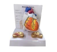 LSOAARRT Atrial Fibrillation Human Education Heart Anatomical Model