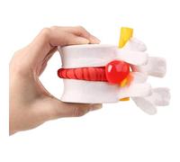 LSOAARRT Human Lumbar Disc Herniation Demonstration Model of Lumbar Vertebral Spine