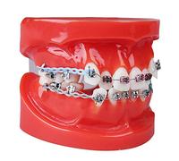 LUCKFY Dental Adult Typodont Demonstration Teeth Model with Mental Brackets Orthodontic Teeth Model with Ligature Ties Red