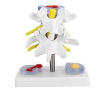 Lumbar Model Anatomical Lumbar Disc Herniation Demonstration Model Human Spine School Training Supplies