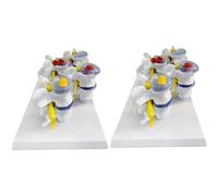 Lumbar Spine Model Lumbar Disc Herniation Model Human Torso Anatomy Model Science Classroom Study Human Organ Model (2