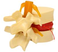 Lumbar Vertebrae Model Anatomical Lumbar Disc Herniation Anatomy Teaching Tool Lumbar Vertebrae Mod