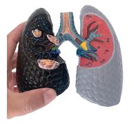 Lung Anatomy Model for Medical Teaching, Human Bronchopulmonary Structure Display, Smoking Effects on Lung Health Comparison Model, Educational Tool
