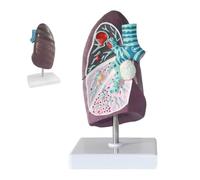 Lung Anatomy Model - Human Pathological Smoker'S Lung Cross-Section With Clear Texture For Medical School Study And Research