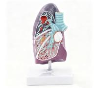 Lung Anatomy Model of Pathology with Base, Unilateral Lung Anatomy Model, Respiratory Medicine Structure Medical Teaching Aid for Doctor-Patient Communication Learning Resources
