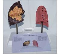Lung anatomy model smoking lung and normal lung comparison Anatomical teaching models Human atmospheric system model for