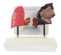 Lung Anatomy Model Teaching Aid Pathological Respiratory for Medical Education and School Use