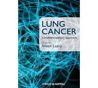 Lung Cancer: A Multidisciplinary Approach