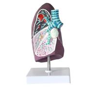 Lung Cancer Model 2:3 Human Lung Anatomy Model Wirh Pathological Features & Clear Texture&Accurate Anatomy Structure For Students To Learn And Display