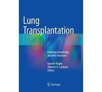 Lung Transplantation: Evolving Knowledge and New Horizons