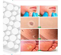 LUNK Upgraded Skin Tag Remover Mole Remover Skin Tag Removal Acne Pimple Healing Patches Removal and Conceals Skin Tag (108Patches)