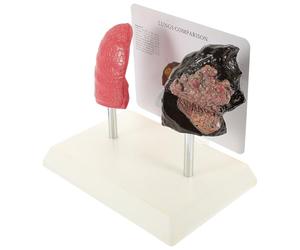 Lurrose Respiratory Lung Model PVC Detailed Lung Structure for Teaching Pathology and Physiology to Students