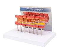 Luxylei Arterial Vessel Atherosclerosis Model Middle-aged and Elderly Blood Vessel Structure Model Teaching Supplies
