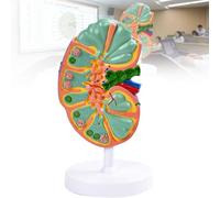 Lymph Node Anatomical Model, Detachable Human Lymphatic System for Immune Structure Study, Ideal for High School Science Labs and Student Education