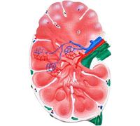 Lymph Node Anatomical Model, Human Lymph Node Enlargement Simulation for Study and Teaching, Double-Sided Display with Clear Internal Structure, Realistic Design