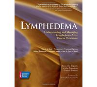 Lymphedema: Understanding and Managing Lymphedema After Cancer Treatment