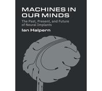 Machines in Our Minds: The Past, Present, and Future of Neural Implants
