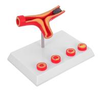 MAGICLULU Human Cardiovascular Blood Flow Model with Detailed Vascular Blockages for Clinical Education Medical Students and Researchers Realistic Anatomical Simulation