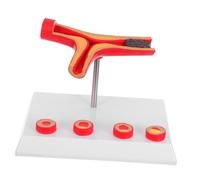MAGICLULU Pvc Vessel Model Human Cardiovascular Models Realistic Simulation High Precision Assorted Colour Diabetes Teaching Tool for Clinical Teaching and Pathological Analysis