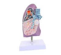 MAGICLULU Smoking Lung Model Pathological Anatomical Teaching Tool for Detailed Respiratory Anatomy for Schools Universities and Patient Communication