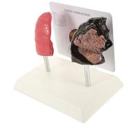 MAGICLULU Vivid Anatomical Lung Model with Smoking and Comparison for Medical Education Teaching Aid for Schools Universities and Training Institutions