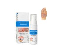 Magnesium Herbal Psoriasis Spray, Magnesium Herbs Hautspray,Herbal Psoriasis Treatment Relief Spray, Gentle Moisturizing for All Skin Types (1)