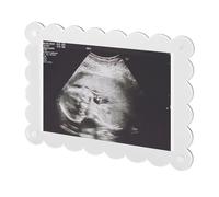 Magnetic Scalloped Acrylic Picture Frame, 7.1x5.1 Inch Baby Scan Photo Frames Pregnancy Announcement Photo Frame Keepsake for Gender Reveal Expectant Parents Gift (Transparent)