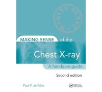 Making Sense of the Chest X-ray: A hands-on guide