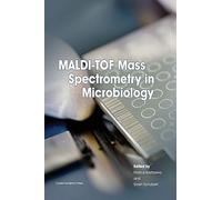 MALDI-TOF Mass Spectrometry in Microbiology