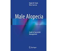 Male Alopecia: Guide to Successful Management