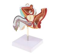 Male Internal Reproductive Pathology Model Disease Anatomical Urinary System