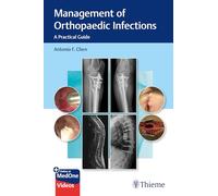 Management of Orthopaedic Infections: A Practical Guide