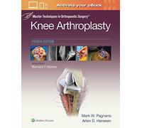 Master Techniques in Orthopedic Surgery: Knee Arthroplasty (Master Techniques in Orthopaed) (Master Techniques in Orthopaedic Surgery)