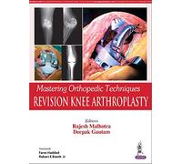 Mastering Orthopedic Techniques: Revision Knee Arthroplasty