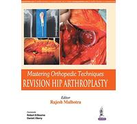 Mastering Orthopedic Techniques: Revision Total Hip Arthroplasty