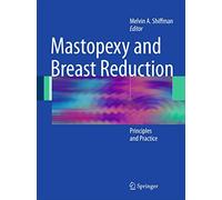 Mastopexy and Breast Reduction: Principles and Practice