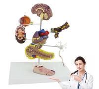 Mavdecll Human Diabetic Pathology Model, Diabetes Model Set with 8 Components, Foot Brain Heart Kidney Thrombosis Model, Diabetes and Complications Display, for Doctor-Patient Communication