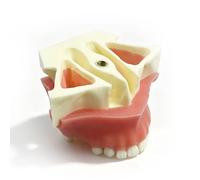 Maxillary Dental Implant Model,Dental Implant Maxillary Sinus Lift Practice Model, Tooth Models Teeth Typodonts for Training Teaching Demo and Study