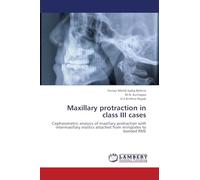 Maxillary protraction in class III cases: Cephalometric analysis of maxillary protraction with intermaxillary elastics attached from miniplates to bonded RME