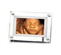 MBHB Digital Picture Frame, 5” Screen, Electronic Photo Frames for Ultrasound Replay, Re-Chargeable 4GB Memory, USB Charging, Vertical/Horizontal Display, Upload Photos/Videos Easily