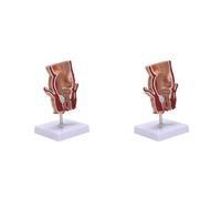 Mcnhbdgg 2X Anatomy Model Human Rectal Lesion Model Fistula Fistula Fissure Pathology Teaching Model
