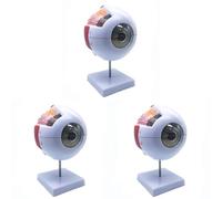 Mcnhbdgg 3pcs 6X Enlarged Human Eye Anatomical Model,Anatomically Accurate Eye Model Human Eye Anatomy