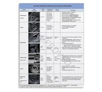 MCQWOMFQAK Early Pregnancy Ultrasound Dictionary Poster First Trimester Sonography Terms Guide for Learning(Framed,16x24inch(40x60cm))