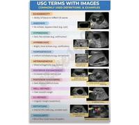 MDBJTCYZN Comprehensive Ultrasound Terms Guide Educational Poster with Visual Charts for Sonography Students Doctors Office or Study Room Wall-Art(Framed,16x24inch(40x60cm))
