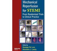Mechanical Reperfusion for STEMI: From Randomized Trials to Clinical Practice